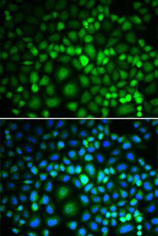 TIP48 / RUVBL2 Antibody - Immunofluorescence analysis of MCF-7 cells using RUVBL2 antibody. Blue: DAPI for nuclear staining.
