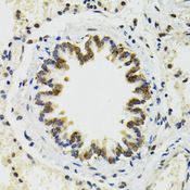 TIP48 / RUVBL2 Antibody - Immunohistochemistry of paraffin-embedded rat lung using RUVBL2 antibody at dilution of 1:100 (40x lens).