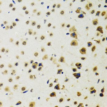 TIP48 / RUVBL2 Antibody - Immunohistochemistry of paraffin-embedded mouse brain using RUVBL2 antibody at dilution of 1:100 (40x lens).