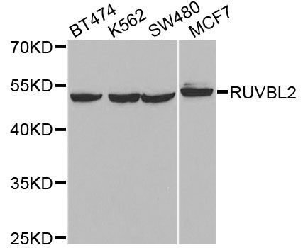 TIP48 / RUVBL2 Antibody - Western blot analysis of extracts of various cell lines, using RUVBL2 antibody at 1:1000 dilution. The secondary antibody used was an HRP Goat Anti-Rabbit IgG (H+L) at 1:10000 dilution. Lysates were loaded 25ug per lane and 3% nonfat dry milk in TBST was used for blocking. An ECL Kit was used for detection and the exposure time was 90s.