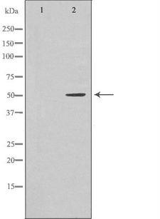 TIP48 / RUVBL2 Antibody - Western blot analysis of HeLa whole cells lysates using RUVBL2 antibody. The lane on the left is treated with the antigen-specific peptide.