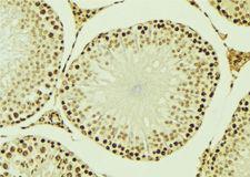 TIP48 / RUVBL2 Antibody - 1:100 staining mouse testis tissue by IHC-P. The sample was formaldehyde fixed and a heat mediated antigen retrieval step in citrate buffer was performed. The sample was then blocked and incubated with the antibody for 1.5 hours at 22°C. An HRP conjugated goat anti-rabbit antibody was used as the secondary.
