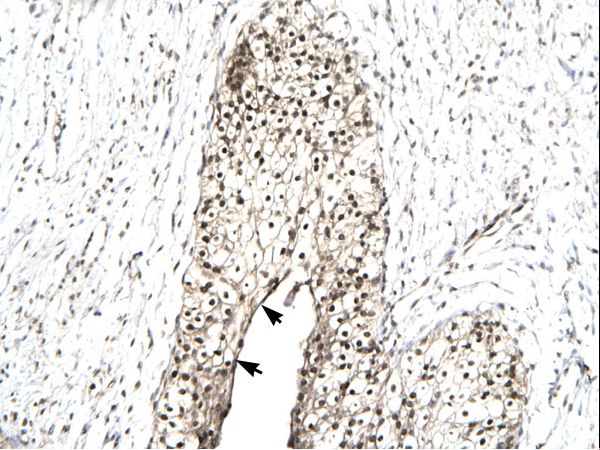 TIP48 / RUVBL2 Antibody - Human Urinary bladder.  This image was taken for the unconjugated form of this product. Other forms have not been tested.