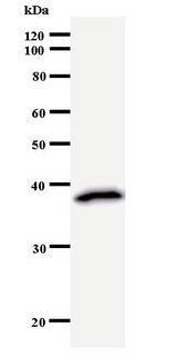 TIP49 / RUVBL1 Antibody - Western blot of immunized recombinant protein using RUVBL1 antibody.