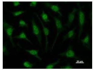 TIP49 / RUVBL1 Antibody - Immunofluorescent staining using RUVBL1 antibody. Immunostaining analysis in HeLa cells. HeLa cells were fixed with 4% paraformaldehyde and permeabilized with 0.01% Triton-X100 in PBS. The cells were immunostained with anti-RUVBL1 antibody.