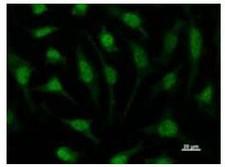 TIP49 / RUVBL1 Antibody - Immunofluorescent staining using RUVBL1 antibody. Immunostaining analysis in HeLa cells. HeLa cells were fixed with 4% paraformaldehyde and permeabilized with 0.01% Triton-X100 in PBS. The cells were immunostained with anti-RUVBL1 antibody.