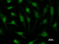 TIP49 / RUVBL1 Antibody - Immunostaining analysis in HeLa cells. HeLa cells were fixed with 4% paraformaldehyde and permeabilized with 0.1% Triton X-100 in PBS. The cells were immunostained with anti-RUVBL1 mAb.