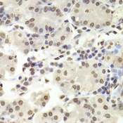 TIP49 / RUVBL1 Antibody - Immunohistochemistry of paraffin-embedded Human gastric tissue.