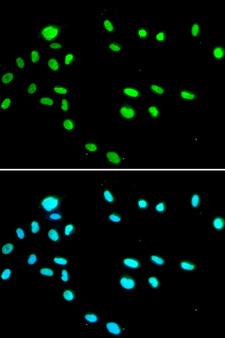 TIP49 / RUVBL1 Antibody - Immunofluorescence analysis of A549 cells.