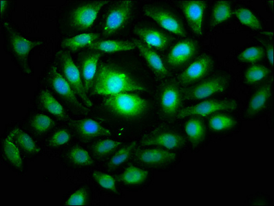 TIP49 / RUVBL1 Antibody - Immunofluorescence staining of A549 cells with RUVBL1 Antibody at 1:266, counter-stained with DAPI. The cells were fixed in 4% formaldehyde, permeabilized using 0.2% Triton X-100 and blocked in 10% normal Goat Serum. The cells were then incubated with the antibody overnight at 4°C. The secondary antibody was Alexa Fluor 488-congugated AffiniPure Goat Anti-Rabbit IgG(H+L).