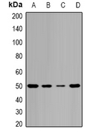 TIP49 / RUVBL1 Antibody - Western blot analysis of Pontin 52 expression in MCF7 (A); HepG2 (B); mouse spleen (C); mouse brain (D) whole cell lysates.