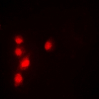 TIP49 / RUVBL1 Antibody - Immunofluorescent analysis of Pontin 52 staining in A549 cells. Formalin-fixed cells were permeabilized with 0.1% Triton X-100 in TBS for 5-10 minutes and blocked with 3% BSA-PBS for 30 minutes at room temperature. Cells were probed with the primary antibody in 3% BSA-PBS and incubated overnight at 4 deg C in a humidified chamber. Cells were washed with PBST and incubated with a DyLight 594-conjugated secondary antibody (red) in PBS at room temperature in the dark.