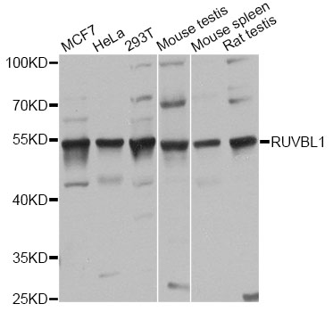 TIP49 / RUVBL1 Antibody - Western blot analysis of extracts of various cell lines, using RUVBL1 antibody at 1:1000 dilution. The secondary antibody used was an HRP Goat Anti-Rabbit IgG (H+L) at 1:10000 dilution. Lysates were loaded 25ug per lane and 3% nonfat dry milk in TBST was used for blocking. An ECL Kit was used for detection and the exposure time was 10s.