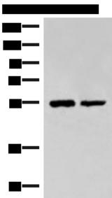 TIP49 / RUVBL1 Antibody - Western blot analysis of Raji and K562 cell lysates  using RUVBL1 Polyclonal Antibody at dilution of 1:2200