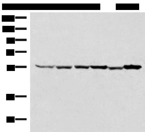 TIP49 / RUVBL1 Antibody - Western blot analysis of 293T HepG2 K562 HT29 A549 and Raji cell lysates  using RUVBL1 Polyclonal Antibody at dilution of 1:2000