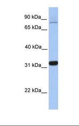 TIPIN Antibody - Fetal heart lysate. Antibody concentration: 1.0 ug/ml. Gel concentration: 12%.  This image was taken for the unconjugated form of this product. Other forms have not been tested.