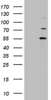 TIPIN Antibody - HEK293T cells were transfected with the pCMV6-ENTRY control (Left lane) or pCMV6-ENTRY TIPIN (Right lane) cDNA for 48 hrs and lysed. Equivalent amounts of cell lysates (5 ug per lane) were separated by SDS-PAGE and immunoblotted with anti-TIPIN.