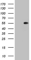 TIPIN Antibody - HEK293T cells were transfected with the pCMV6-ENTRY control (Left lane) or pCMV6-ENTRY TIPIN (Right lane) cDNA for 48 hrs and lysed. Equivalent amounts of cell lysates (5 ug per lane) were separated by SDS-PAGE and immunoblotted with anti-TIPIN.