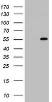 TIPIN Antibody - HEK293T cells were transfected with the pCMV6-ENTRY control (Left lane) or pCMV6-ENTRY TIPIN (Right lane) cDNA for 48 hrs and lysed. Equivalent amounts of cell lysates (5 ug per lane) were separated by SDS-PAGE and immunoblotted with anti-TIPIN.