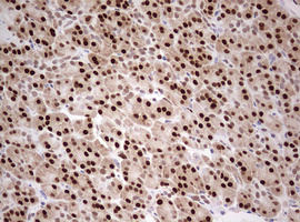 TIPIN Antibody - IHC of paraffin-embedded Human pancreas tissue using anti-TIPIN mouse monoclonal antibody. (Heat-induced epitope retrieval by 10mM citric buffer, pH6.0, 120°C for 3min).