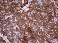 TIPIN Antibody - IHC of paraffin-embedded Human pancreas tissue using anti-TIPIN mouse monoclonal antibody. (Heat-induced epitope retrieval by 1 mM EDTA in 10mM Tris, pH8.5, 120°C for 3min).