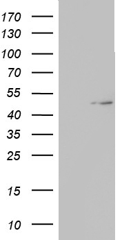 TIPIN Antibody - HEK293T cells were transfected with the pCMV6-ENTRY control (Left lane) or pCMV6-ENTRY TIPIN (Right lane) cDNA for 48 hrs and lysed. Equivalent amounts of cell lysates (5 ug per lane) were separated by SDS-PAGE and immunoblotted with anti-TIPIN.