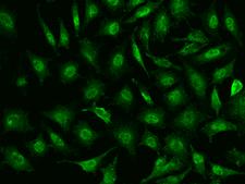 TIPIN Antibody - Immunofluorescence staining of TIPIN in HeLa cells. Cells were fixed with 4% PFA, permeabilzed with 0.1% Triton X-100 in PBS, blocked with 10% serum, and incubated with rabbit anti-Human TIPIN polyclonal antibody (dilution ratio 1:200) at 4°C overnight. Then cells were stained with the Alexa Fluor 488-conjugated Goat Anti-rabbit IgG secondary antibody (green). Positive staining was localized to Nucleus and cytoplasm.
