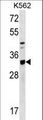 TIPRL / TIP Antibody - TIPRL Antibody western blot of K562 cell line lysates (35 ug/lane). The TIPRL antibody detected the TIPRL protein (arrow).