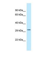 TIPRL / TIP Antibody - Western blot of Human THP-1. TIPRL antibody dilution 1.0 ug/ml.  This image was taken for the unconjugated form of this product. Other forms have not been tested.