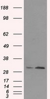 TIPRL / TIP Antibody - HEK293T cells were transfected with the pCMV6-ENTRY control (Left lane) or pCMV6-ENTRY TIPRL (Right lane) cDNA for 48 hrs and lysed. Equivalent amounts of cell lysates (5 ug per lane) were separated by SDS-PAGE and immunoblotted with anti-TIPRL.
