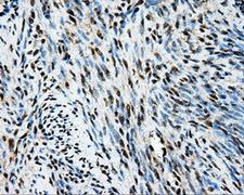 TIPRL / TIP Antibody - Immunohistochemical staining of paraffin-embedded endometrium tissue using anti-TIPRL mouse monoclonal antibody. (Dilution 1:50).