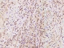TIPRL / TIP Antibody - Immunochemical staining of human TIPRL in human adrenal gland with rabbit polyclonal antibody at 1:500 dilution, formalin-fixed paraffin embedded sections.