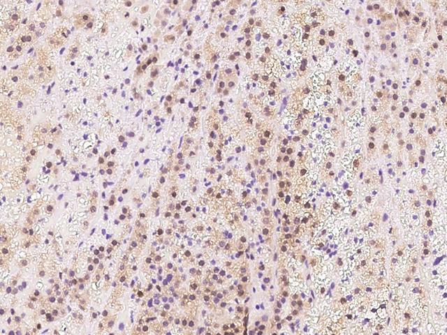 TIPRL / TIP Antibody - Immunochemical staining of human TIPRL in human adrenal gland with rabbit polyclonal antibody at 1:500 dilution, formalin-fixed paraffin embedded sections.