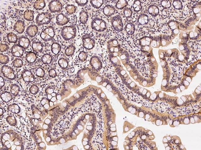 TIPRL / TIP Antibody - Immunochemical staining of human TIPRL in human duodenum with rabbit polyclonal antibody at 1:500 dilution, formalin-fixed paraffin embedded sections.