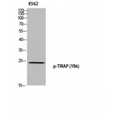 TIRAP Antibody - Western blot of Phospho-TIRAP (Y86) antibody
