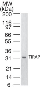 TIRAP Antibody - Western blot of TIRAP in human spleen lysate using Monoclonal Antibody to human TIRAP (TIR domain-containing adaptor protein) at 1:500.