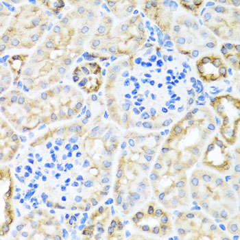 TIRAP Antibody - Immunohistochemistry of paraffin-embedded mouse kidney using TIRAP antibody at dilution of 1:100 (40x lens).