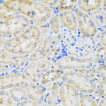 TIRAP Antibody - Immunohistochemistry of paraffin-embedded rat kidney using TIRAP antibody at dilution of 1:100 (40x lens).