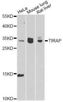 TIRAP Antibody - Western blot analysis of extracts of various cell lines, using TIRAP antibody at 1:1000 dilution. The secondary antibody used was an HRP Goat Anti-Rabbit IgG (H+L) at 1:10000 dilution. Lysates were loaded 25ug per lane and 3% nonfat dry milk in TBST was used for blocking. An ECL Kit was used for detection and the exposure time was 90s.