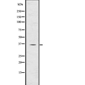 TIRAP Antibody - Western blot analysis of TIRAP using K562 whole lysates.