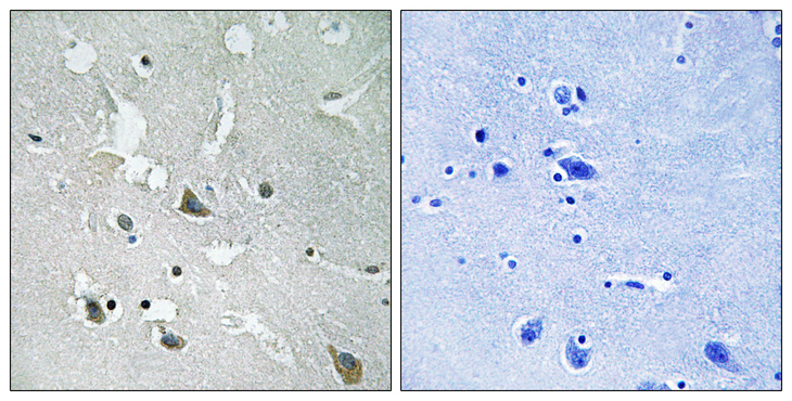 TIRAP Antibody - Immunohistochemistry analysis of paraffin-embedded human brain, using TIRAP (Phospho-Tyr86) Antibody. The picture on the right is blocked with the phospho peptide.