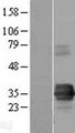 TIRAP Protein - Western validation with an anti-DDK antibody * L: Control HEK293 lysate R: Over-expression lysate