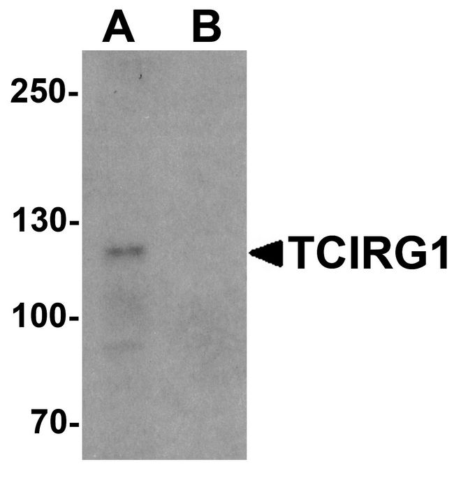 TIRC7 / TCIRG1 Antibody - Western blot analysis of TCIRG1 in EL4 cell lysate with TCIRG1 antibody at 0.5 ug/ml in (A) the absence and (B) the presence of blocking peptide.