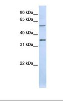 TJAP1 Antibody - Placenta lysate. Antibody concentration: 1.0 ug/ml. Gel concentration: 12%.  This image was taken for the unconjugated form of this product. Other forms have not been tested.
