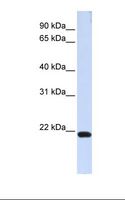 TJAP1 Antibody - 293T cell lysate. Antibody concentration: 1.0 ug/ml. Gel concentration: 12%.  This image was taken for the unconjugated form of this product. Other forms have not been tested.