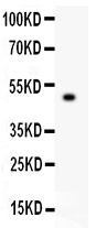 TJP1 / ZO-1 Antibody - TJP1 antibody Western blot. All lanes: Anti TJP1 at 0.5 ug/ml. WB: Recombinant Human TJP1 Protein 0.5ng. Predicted band size: 48 kD. Observed band size: 48 kD.