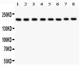 TJP1 / ZO-1 Antibody - TJP1 antibody Western blot. All lanes: Anti TJP1 at 0.5 ug/ml. Lane 1: Rat Liver Tissue Lysate at 50 ug. Lane 2: Mouse Liver Tissue Lysate at 50 ug. Lane 3: NRK Whole Cell Lysate at 40 ug. Lane 4: PC-12 Whole Cell Lysate at 40 ug. Lane 5: HELA Whole Cell Lysate at 40 ug. Lane 6: SMMC Whole Cell Lysate at 40 ug. Lane 7: HEPA Whole Cell Lysate at 40 ug. Lane 8: COLO320 Whole Cell Lysate at 40 ug. Predicted band size: 195 kD. Observed band size: 195 kD.