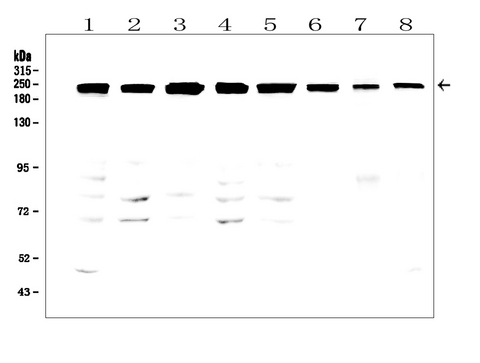 TJP1 / ZO-1 Antibody - Western blot analysis of TJP1 using anti-TJP1 antibody. Electrophoresis was performed on a 5-20% SDS-PAGE gel at 70V (Stacking gel) / 90V (Resolving gel) for 2-3 hours. The sample well of each lane was loaded with 50ug of sample under reducing conditions. Lane 1: human A431 whole cell lysates, Lane 2: human Caco-2 whole cell lysates, Lane 3: human U2OS whole cell lysates, Lane 4: human K562 whole cell lysates. Lane 5: human PC-3 whole cell lysates, Lane 6: human T-47D whole cell lysates, Lane 7: rat ovary tissue lysates, Lane 8: mouse ovary tissue lysates. After Electrophoresis, proteins were transferred to a Nitrocellulose membrane at 150mA for 50-90 minutes. Blocked the membrane with 5% Non-fat Milk/ TBS for 1.5 hour at RT. The membrane was incubated with rabbit anti-TJP1 antigen affinity purified polyclonal antibody at 0.5 µg/mL overnight at 4°C, then washed with TBS-0.1% Tween 3 times with 5 minutes each and probed with a goat anti-rabbit IgG-HRP secondary antibody at a dilution of 1:10000 for 1.5 hour at RT. The signal is developed using an Enhanced Chemiluminescent detection (ECL) kit with Tanon 5200 system. A specific band was detected for TJP1 at approximately 220-240KD. The expected band size for TJP1 is at 195KD.