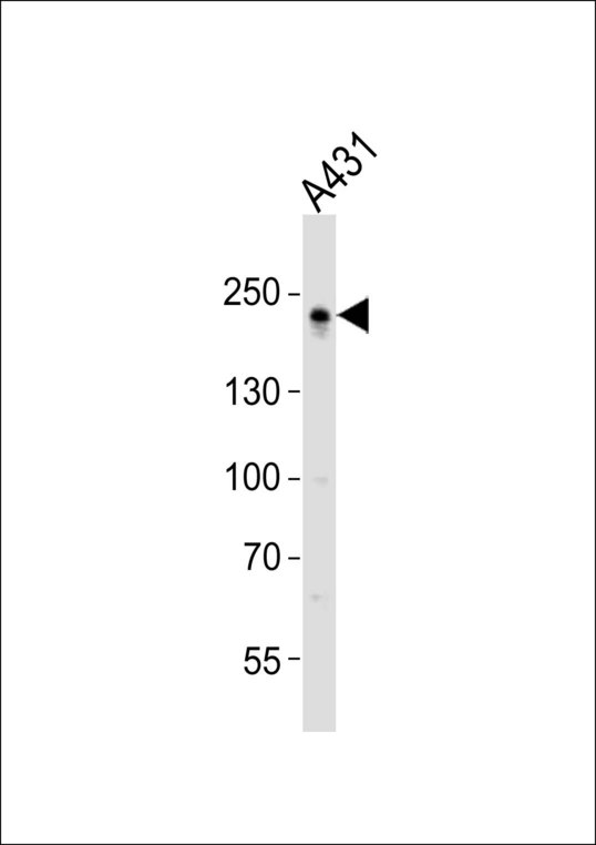 TJP1 / ZO-1 Antibody - Western blot of lysate from A431 cell line, using TJP1 antibody diluted at 1:1000. A goat anti-rabbit IgG H&L (HRP) at 1:10000 dilution was used as the secondary antibody. Lysate at 20 ug.