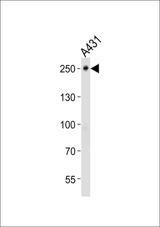 TJP1 / ZO-1 Antibody - Western blot of lysate from A431 cell line, using TJP1 Antibody diluted at 1:1000. A goat anti-rabbit IgG H&L (HRP) at 1:10000 dilution was used as the secondary antibody. Lysate at 20 ug.